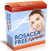Rosacea Free Forever